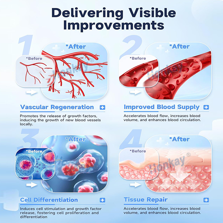 focused shockwave therapy machine cost