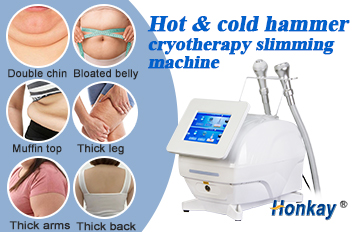 at home fat freezing machine