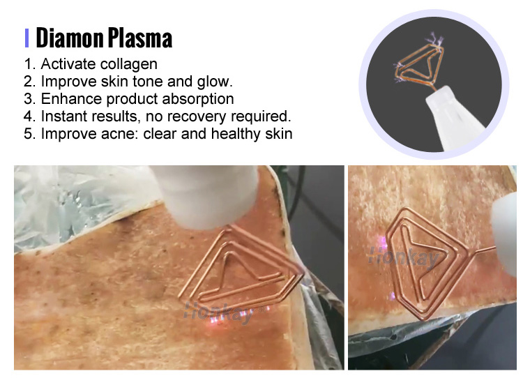 best fibroblast plasma pen