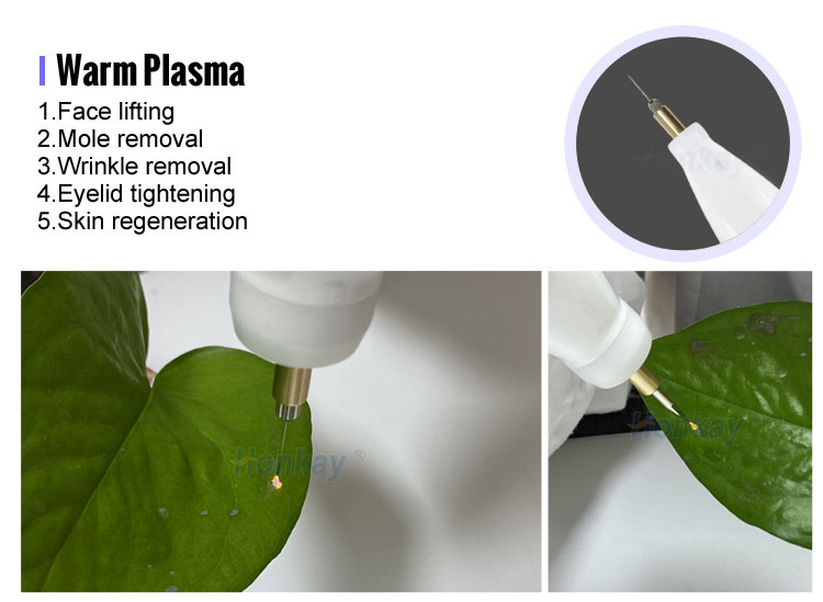 fibroblast plasma pen